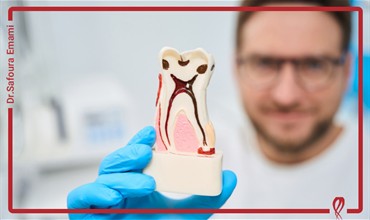 آیا بیماران دیابتی به درمان ریشه متفاوتی نیاز دارند؟